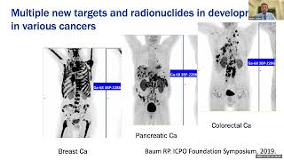 Grand Rounds 2023.11.1