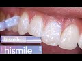 THE TRUTH: Hismile Glostik Tooth Gloss