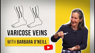 Home Remedies for Varicose Veins - Barbara O'Neill