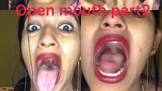 Open mouth part2