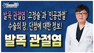 발목 관절염 '고정술'과 '인공관절 수술'의 장, 단점에 대한 정보를 이 영상에서 확인하세요!