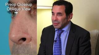 Paul Nassif, MD endorses Dean Toriumi, MD