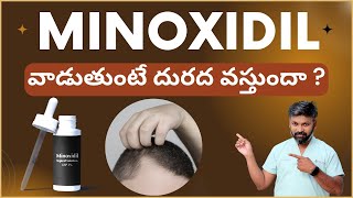 #AskDrJohnWatts | MINOXIDIL వాడుతుంటే దురద వస్తుందా ? | Hair Specialist Explains