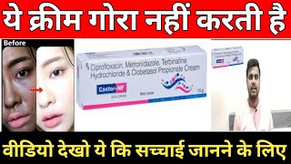 Castor -NF cream| क्या ये क्रीम सच में गोरा करती है|@MediReview