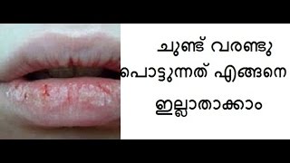 ചുണ്ട് വരണ്ടു പൊട്ടുന്നതു ഇല്ലാതാക്കാന്‍/Home remedy 4dry lips/Winter skincare Tips/No.213