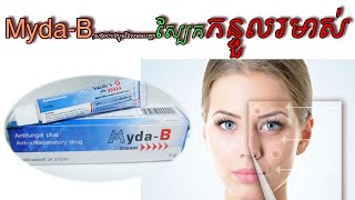 Myda B,សម្រាប់បងប្អូនដែលមានបញ្ហាស្បែកកន្ទួលរមាស់