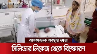 কেরানীগঞ্জে একই পরিবারের ৫ জন দগ্ধ, দুই শিশুর শ্বাসনালী পুড়ে গেছে | Keraniganj Fire