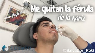 Me quitaron la férula