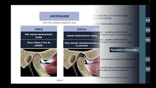 Ancoragem Única e Dupla para Diferentes Tipos de Variações de Reposicionamento do Disco Articular