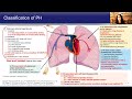 Pulmonary Arterial Hypertension: The Diagnosis You Don't Want to Miss