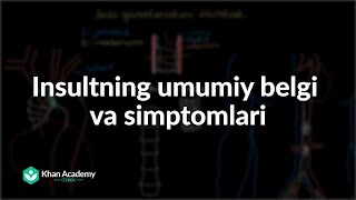 Insultning umumiy belgi va simptomlari | Insult | Tibbiyot