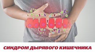 Синдром дырявого кишечника