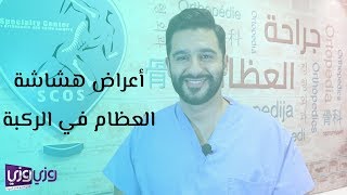 أعراض هشاشة العظام في الركبة