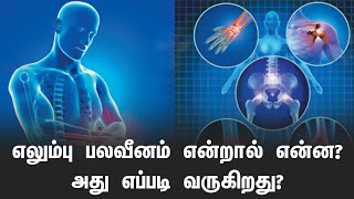 எலும்பு பலவீனம் என்றால் என்ன? What is bone weakness?