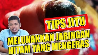 Tips jitu melunakan jaringan HITAM DAN MENGERAS