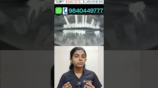 Basal implant இந்த patient-க்கு தேர்வு செய்தது ஏன்? Why basal implant chosen for this patient#shorts