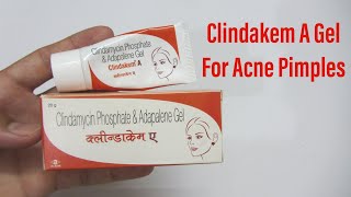 Clindakem A के लाभ और उपयोग करने का तरीका - Clindakem A Benefits \u0026 Uses in Hindi