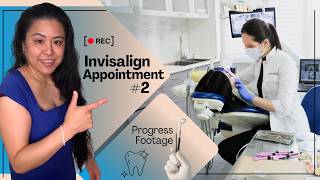 Transforming Smiles: Step-by-Step Guide to the Invisalign First Procedure [UNPAID \u0026 UNSPONSORED]