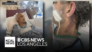 Security guard arrested for brutal beating of West Hollywood hairstylist