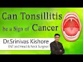 Can Tonsillitis be a Sign of Cancer ? | Dr. Srinivas Kishore | ENT and Head & Neck surgeon