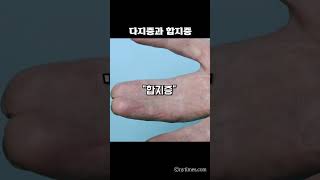 손가락이 6개인 사람들 ㅎㄷㄷ;