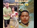 helpless condition 😱 legend girl and her husband shorts ytshorts nagaland india