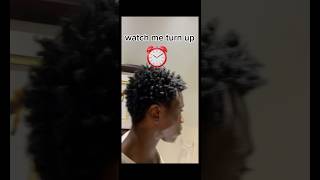 Freeform dreads “ugly stage” motivation! Before and after #freeformlocs #shorts #dreadlocks