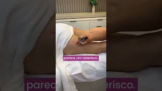 NÃO CONSEGUE TRATAR A CELULITE COM A MASSAGEM? #TratamentoCelulite #MassagemProfissional