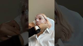The Aftermath of My Skincare Nightmare