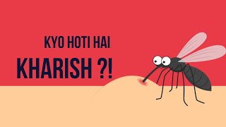 Machar ke katne se kharish kyo hoti hai?? || why does it itch when a mosquito bites you??