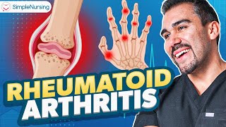 Rheumatoid Arthritis Diagnostics | Nursing Immunosuppressants Osteoarthritis