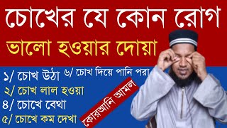 চোখ উঠা চোখ দিয়ে পানি পরা চোখে কম দেখা চোখে বেথা করা চোখের সমস্ত রোগের সমাধান | কোরআনী আমল দারা