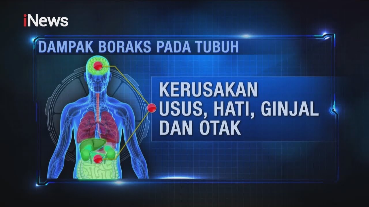 Bahaya Kandungan Boraks Bagi Kesehatan Tubuh Part 03 #iNewsFiles 19/02 ...