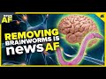 Removing Brain Worms is News AF - August 29, 2023