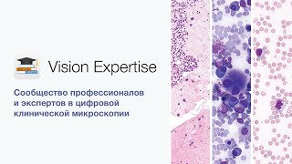 Vision Expertise | Цифровой обучающий сервис