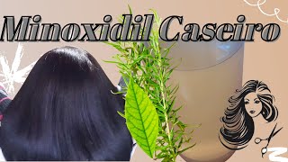 Minoxidil caseiro,como fazer? Ana Calixto