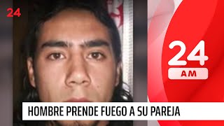 Femicidio frustrado: hombre quemó con combustible a su pareja | 24 Horas TVN Chile