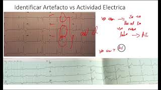 Algortimo:Versión Corta Identificar Artefacto vs Actividad Electrica