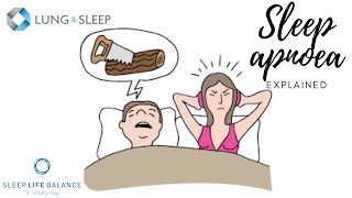 Is my snoring causing obstructive sleep apnoea?