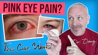 Pink Eye Cure Dr Doug