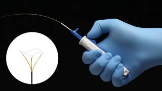 Dakota™ Nitinol Stone Retrieval Device with OpenSure™ Handle