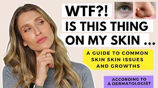 A Dermatologist's Guide to Skin Growths | Dr. Sam Ellis