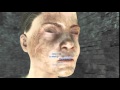 FO:4 No eyes glitch