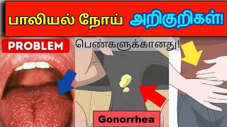 பெண்களுக்கான பாலியல் நோய் அறிகுறிகள்/Aids symptoms in Tamil/AIDS in Tamil/hiv explained in tamil