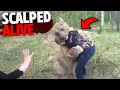 This Man Was SCALPED ALIVE By Bear In Front of His Wife!