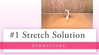 Dermaclara Silicone Fusion™ Patches prevent and reduce the appearance of Stretch Marks and Scars.