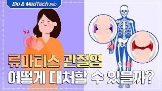 [셀트리온 C FILES] 류마티스 관절염 어떻게 대처할 수 있을까