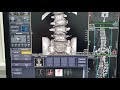 l spine ct 3d image