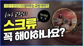 교정용 미니 스크류  , 잇몸 나사 왜 심는지 총정리!  Why mini screw  ?