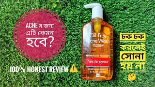 Neutrogena Oil-Free Acne Wash Review || এটি কাদের জন্য Recommended?|| Oily Skin এর জন্য কেমন হবে🤔||